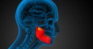 What is Jaw Joint Treatment