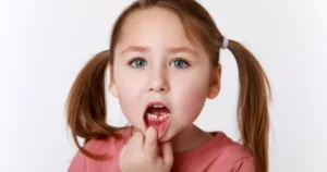 أسنان الأطفال