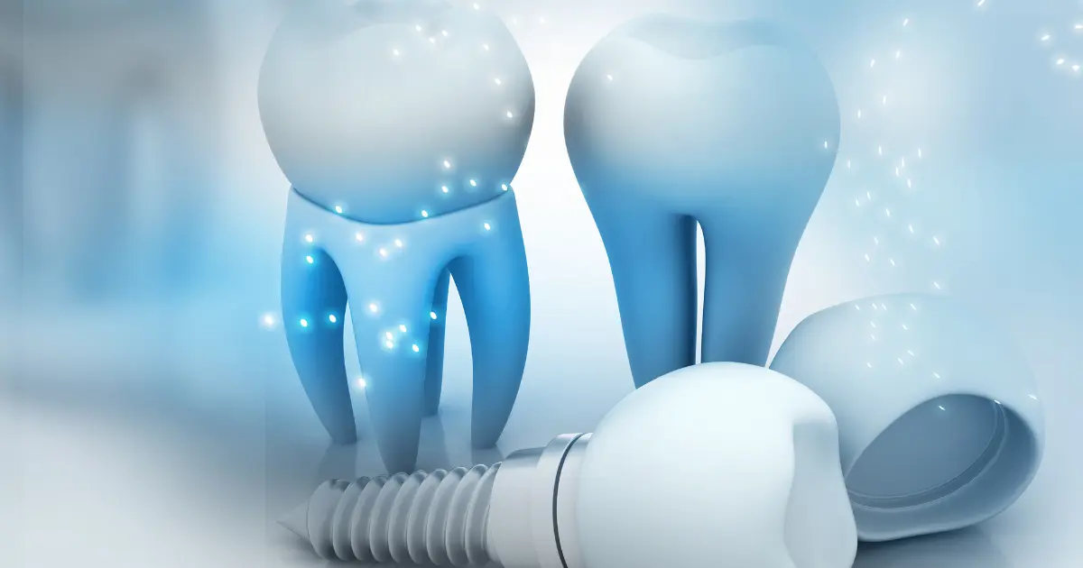 les implants all on 4