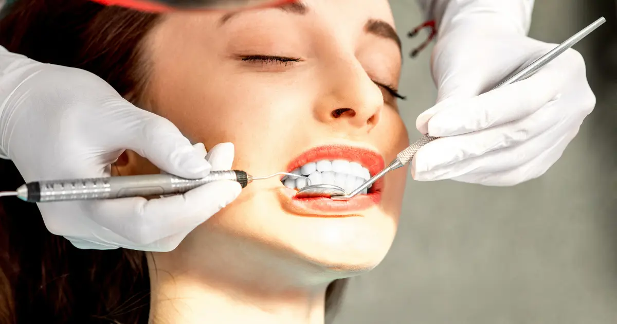 remodelage des dents