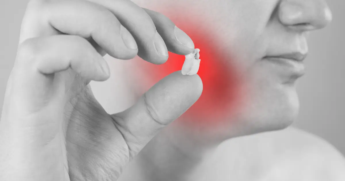 lextraction des dents de sagesse