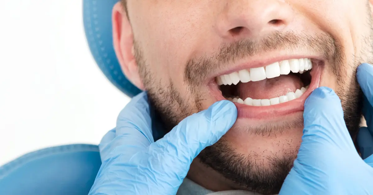 esthétique du sourire