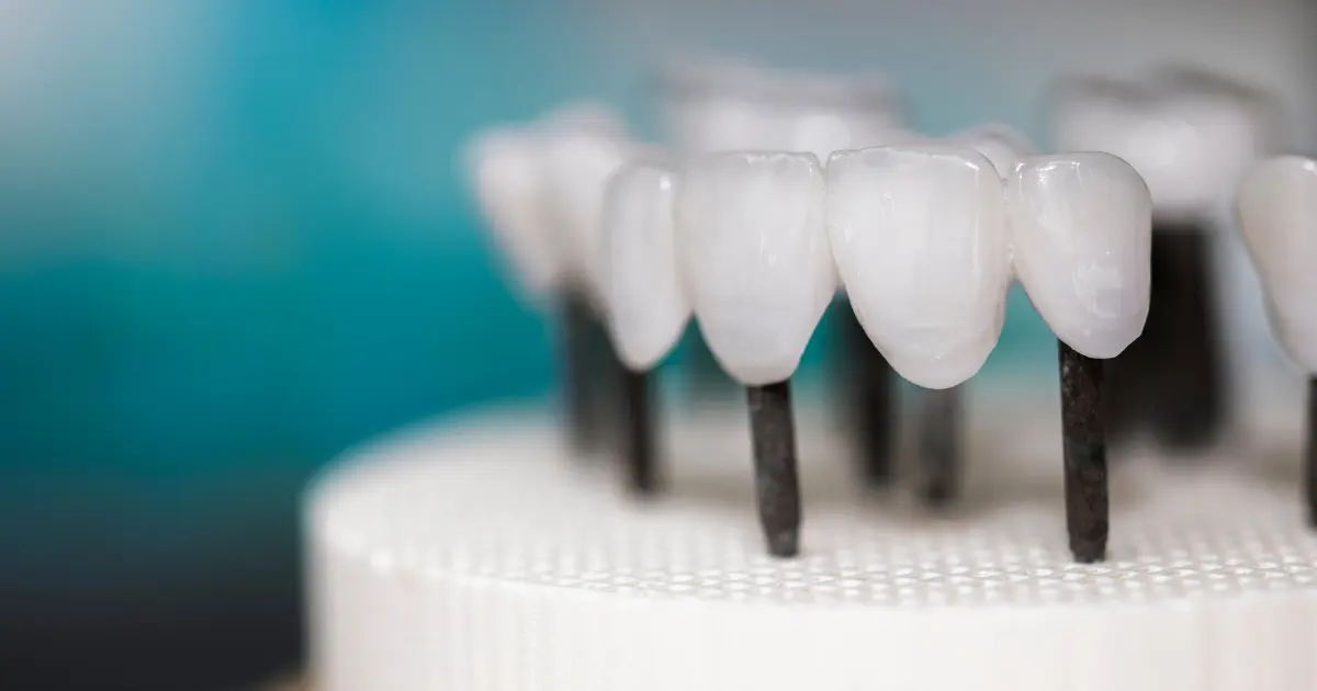 types de prothèses dentaires