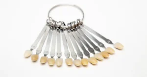 الأسنان الخزفية