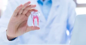 طلاء الأسنان