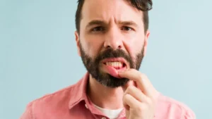 What is Gingivitis? Gingivitis Treatment