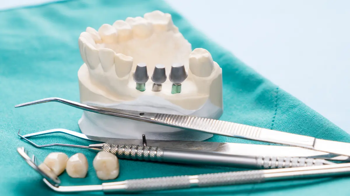 Types Of İmplant-Supported Dentures