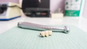 Diş köprüsü nedir nasıl yapılır?