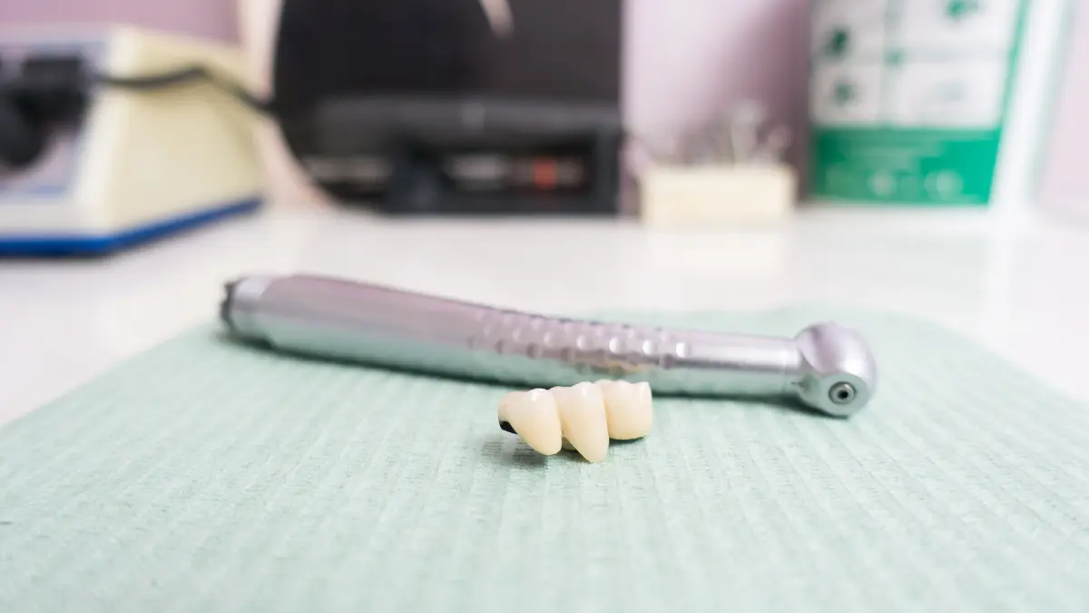 Diş köprüsü nedir nasıl yapılır?