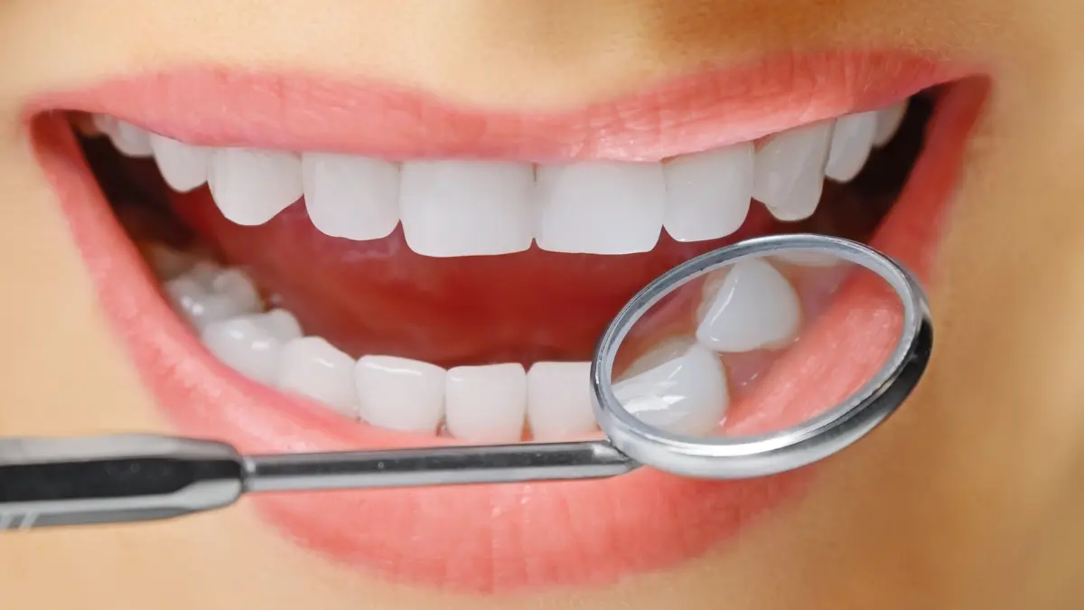 Gülüş tasarımı ile ideal gülüşünüze kavuşun.