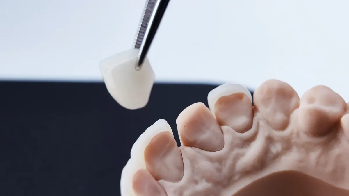 how long the coatings made with the bonding method