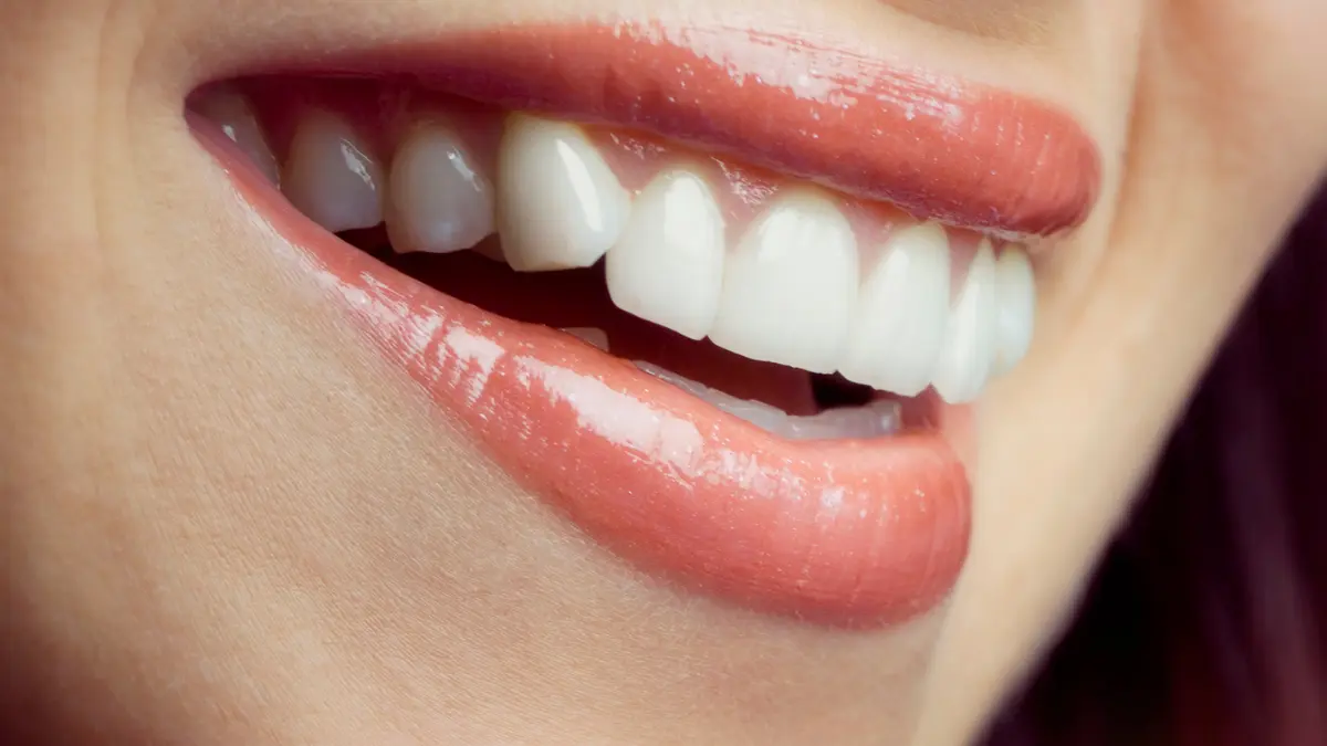 İdeal gülüşün bileşenleri nelerdir? Gülüş tasarımı nedir?