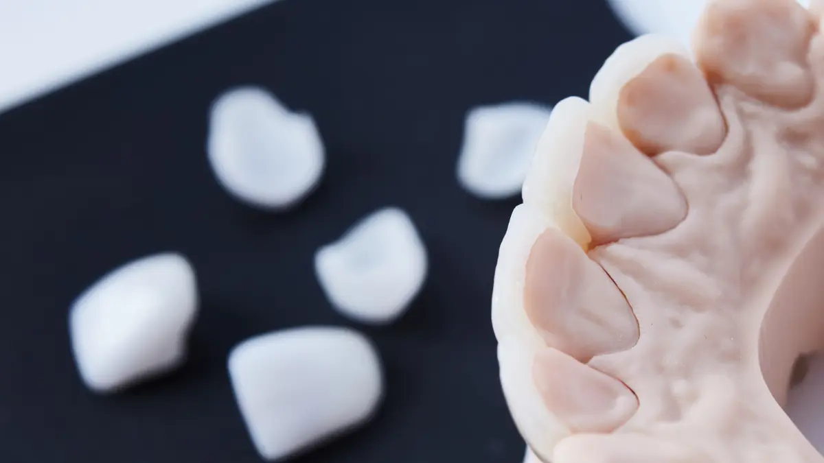 revêtement de collage