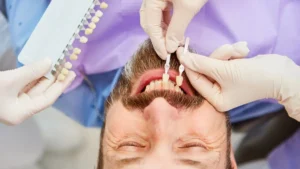 what is bonding coating