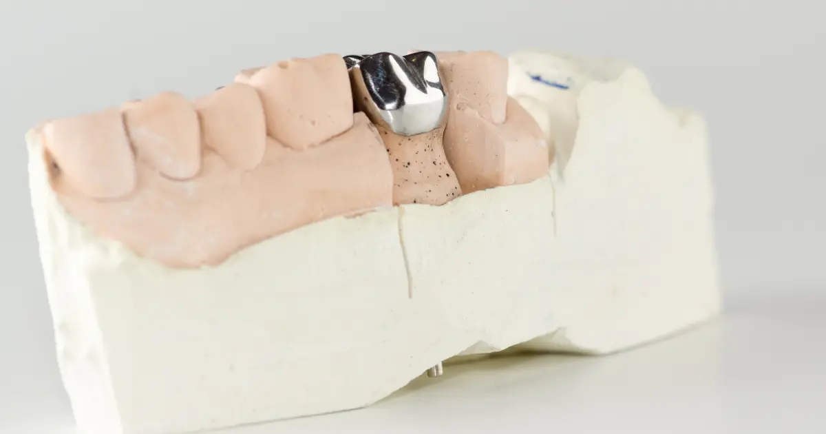 التاج المصنوع من الفولاذ