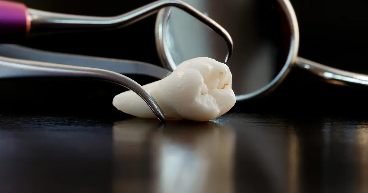 Dental Operculum and Its Effects on Oral Health