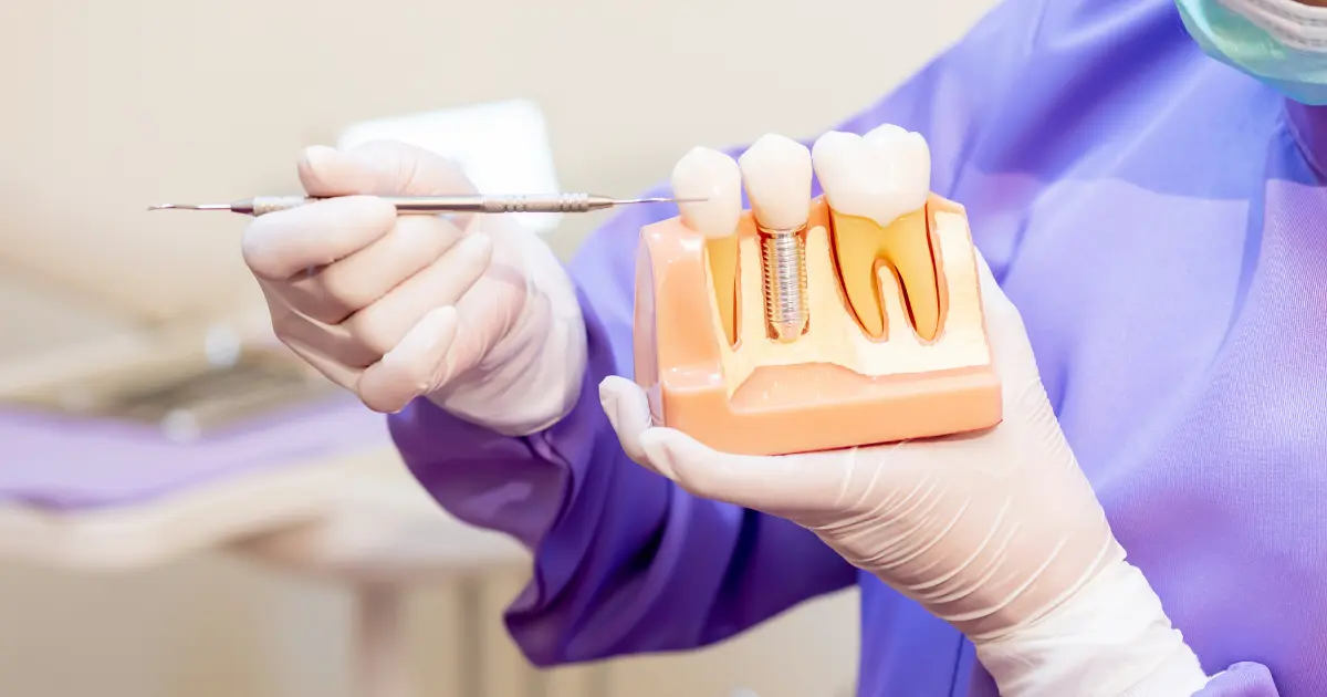 Dentisterie implantaire