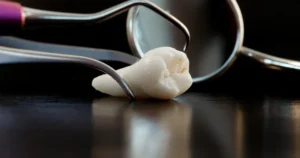 Diş Operkülü ve Ağız Sağlığı Üzerine Etkileri