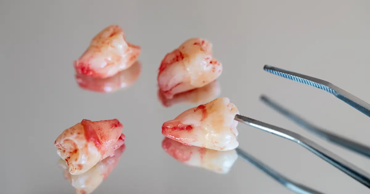 Diş Operkülünün Belirti ve Semptomları