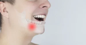 Kuru Soket (Alveolar Osteit) Nedir?