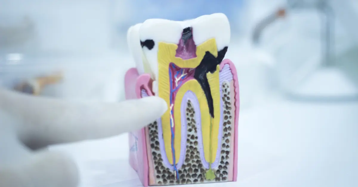 Les causes de l’abrasion dentaire