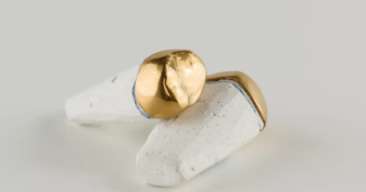 Paslanmaz Çelik Taç Ne Kadar Ömürlüdür?