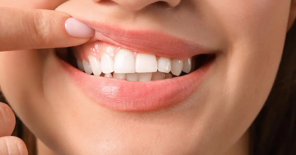Pourquoi la gingivectomie est-elle pratiquée