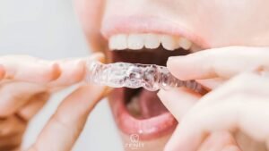 اللوحة الليلية