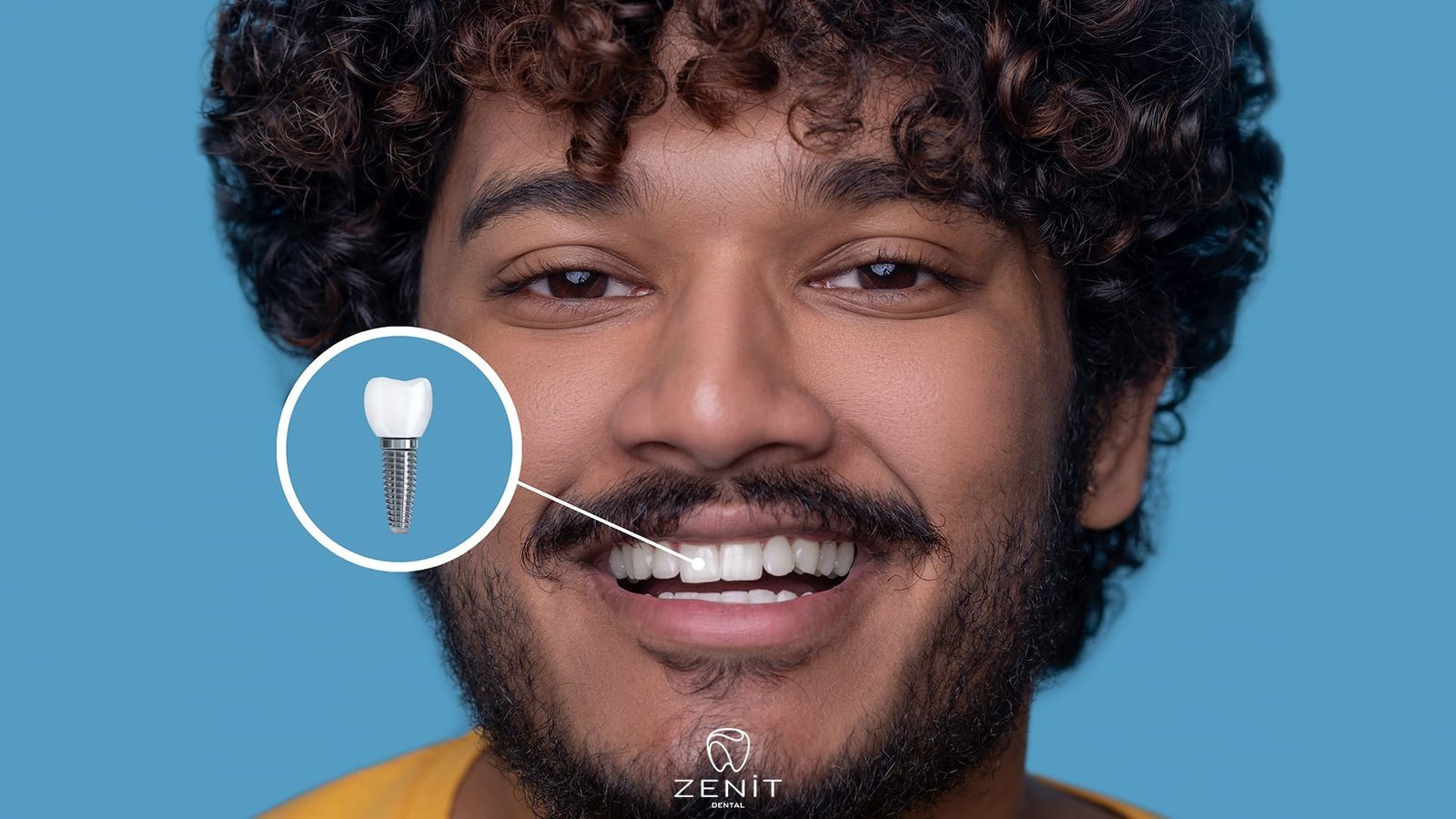 Oral Care After Implantation