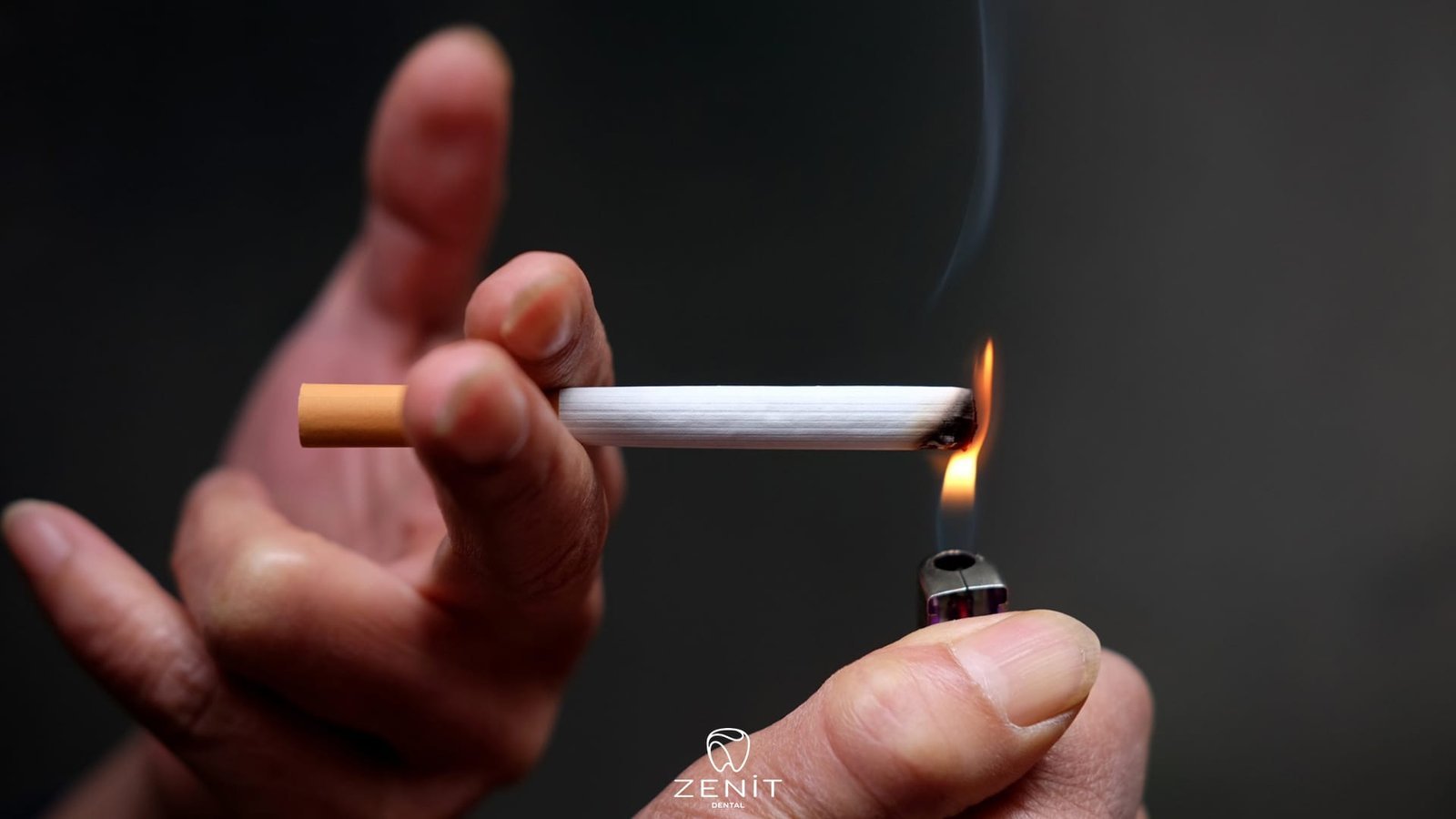 Sigara Kullanımı Diş Eti Hastalığına Sebep Olur Mu?