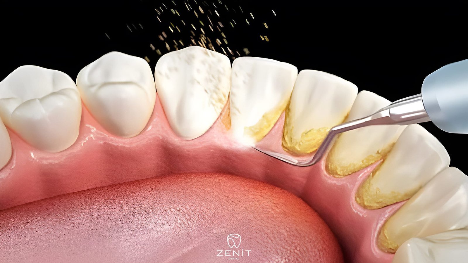 Zahnzwischenräume Reinigen