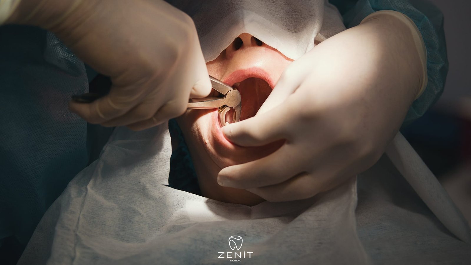 Schmerzen durch Weisheitszähne - Wie man sie lindert