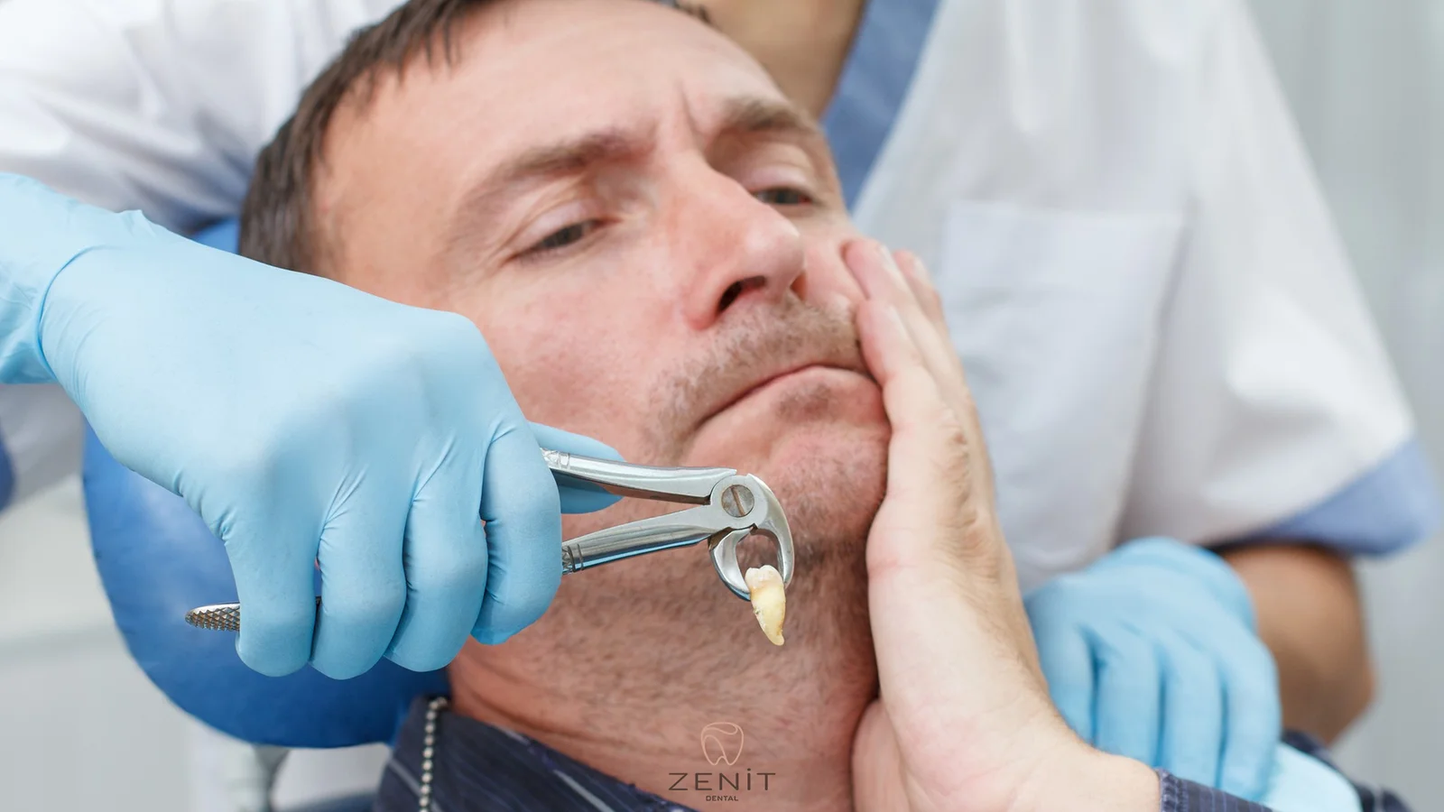 خلع الأسنان