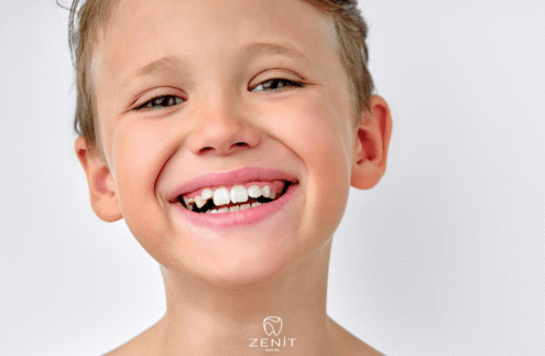 Süt Dişleri Ne Zaman Dökülür