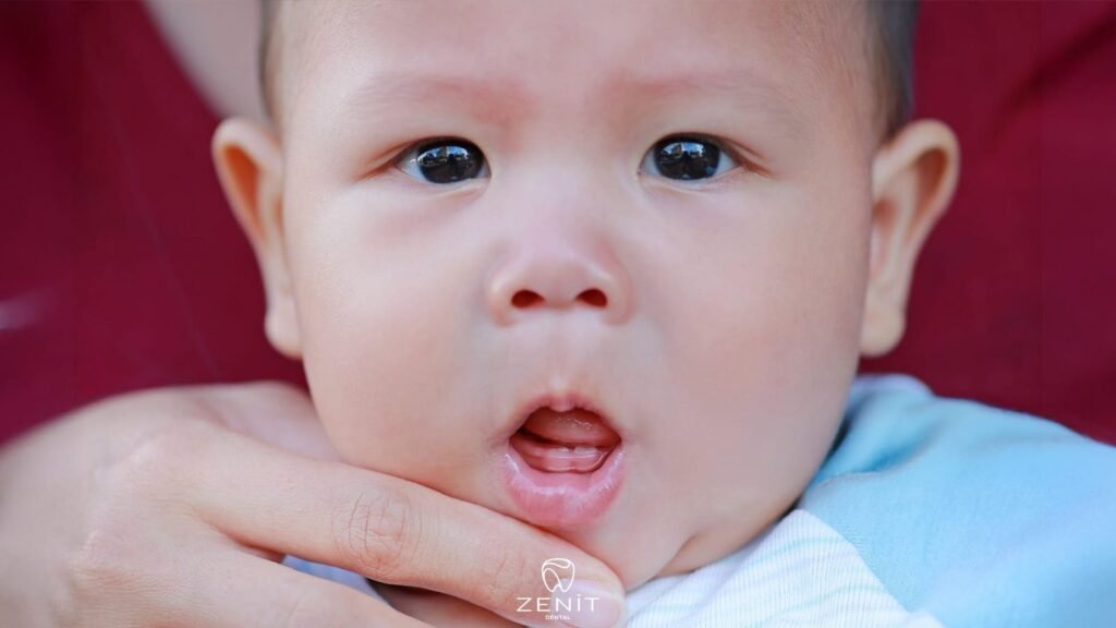 Bad Breath in Babies