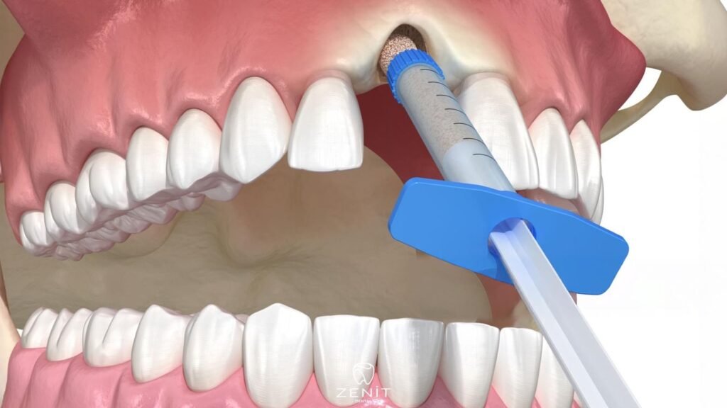 What is Augmentation