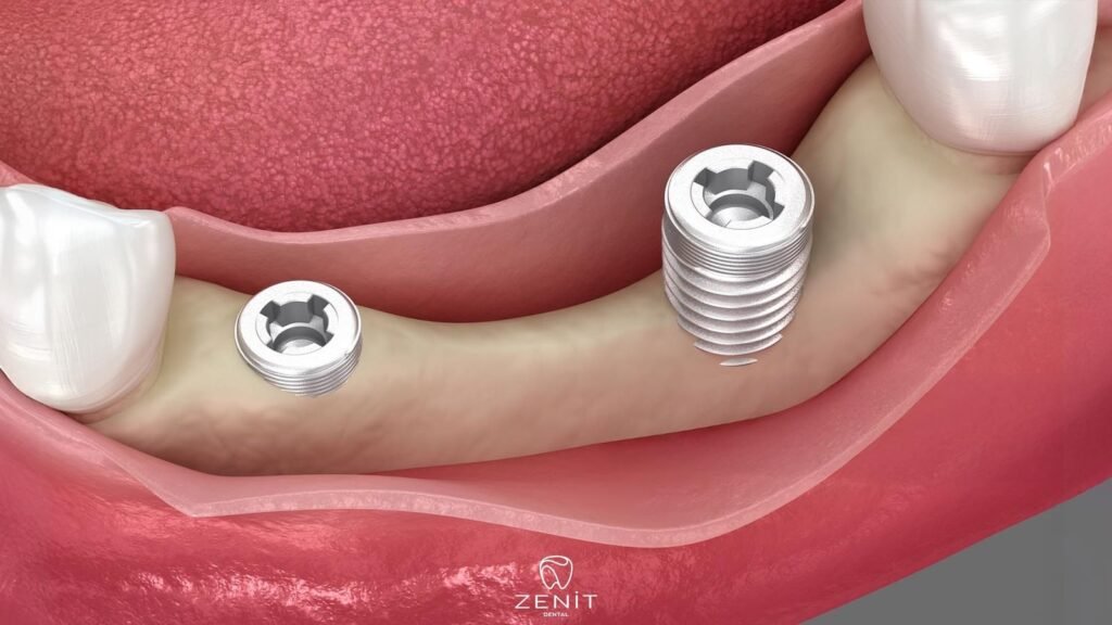 What is Augmentation