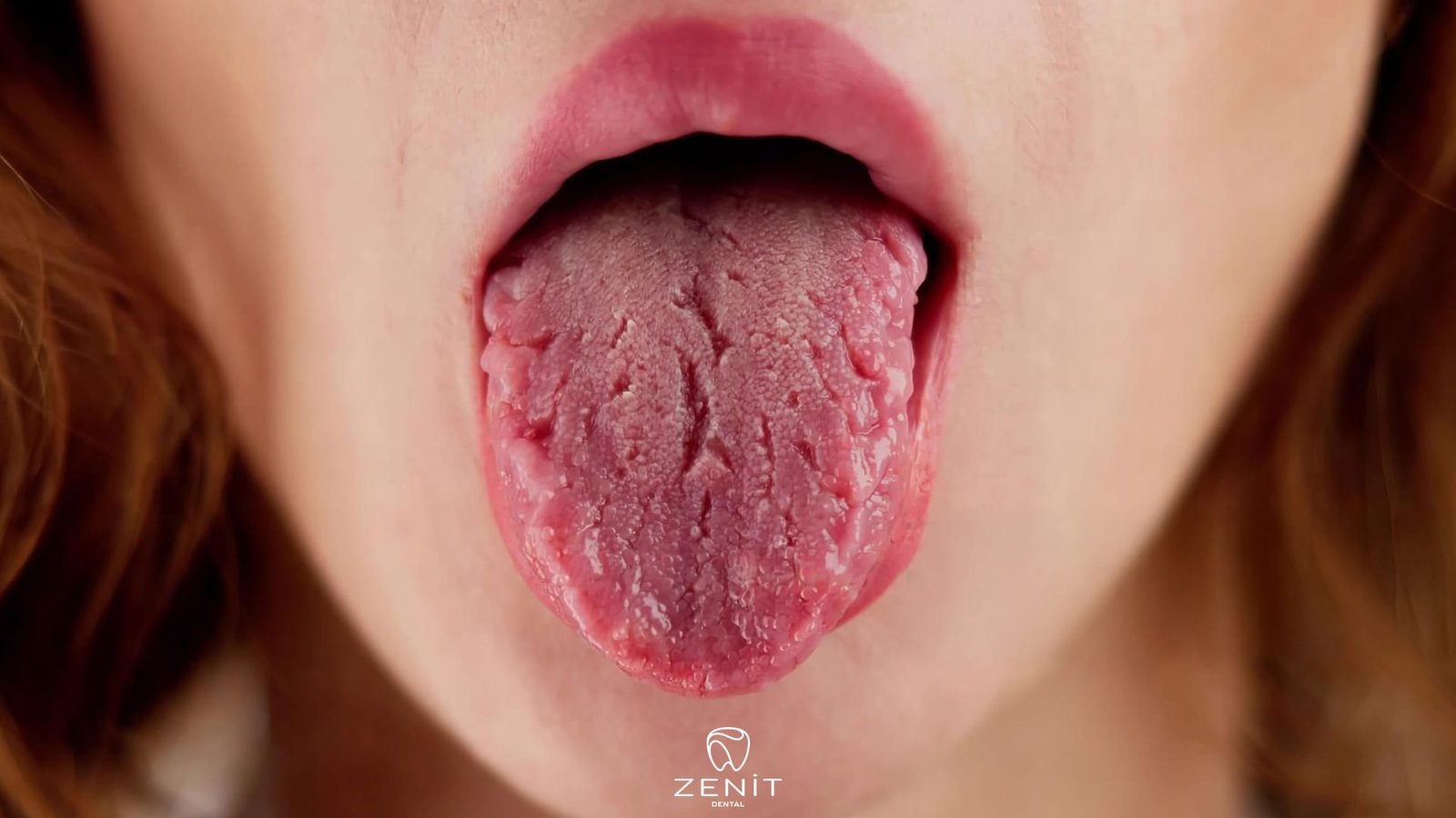 Ağız Kuruluğu Nedenleri