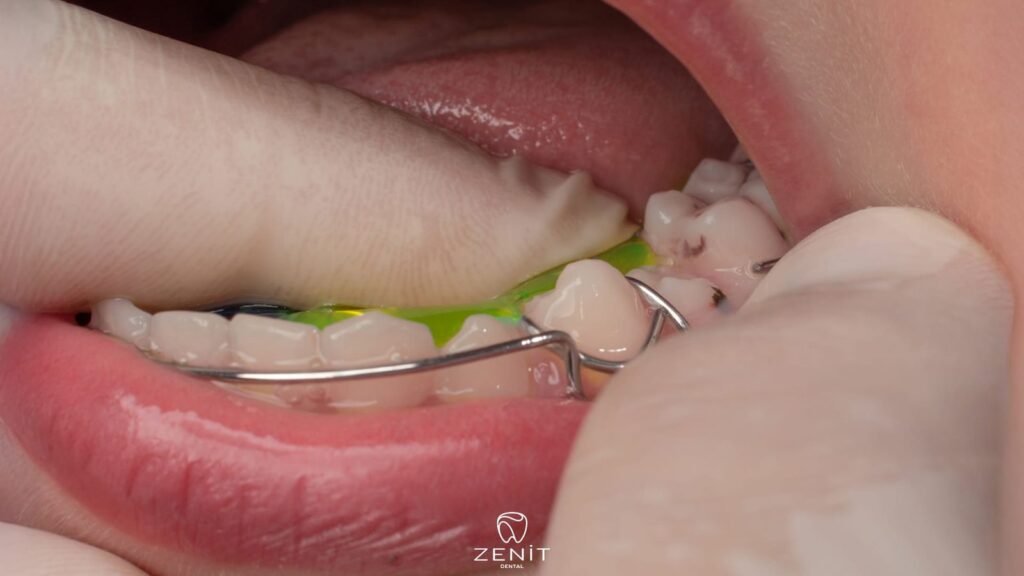 What is a Placeholder