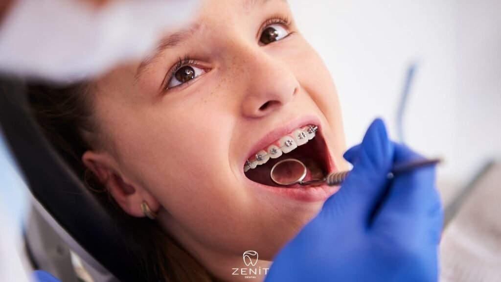 What Is Orthodontic Treatment