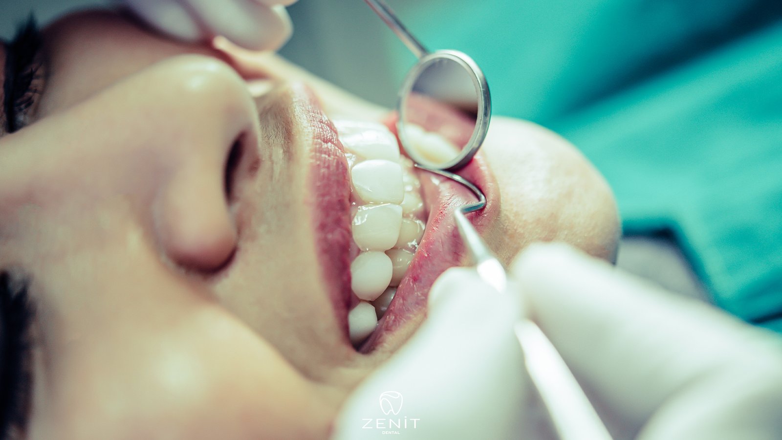 ağız ve çene cerrahisi