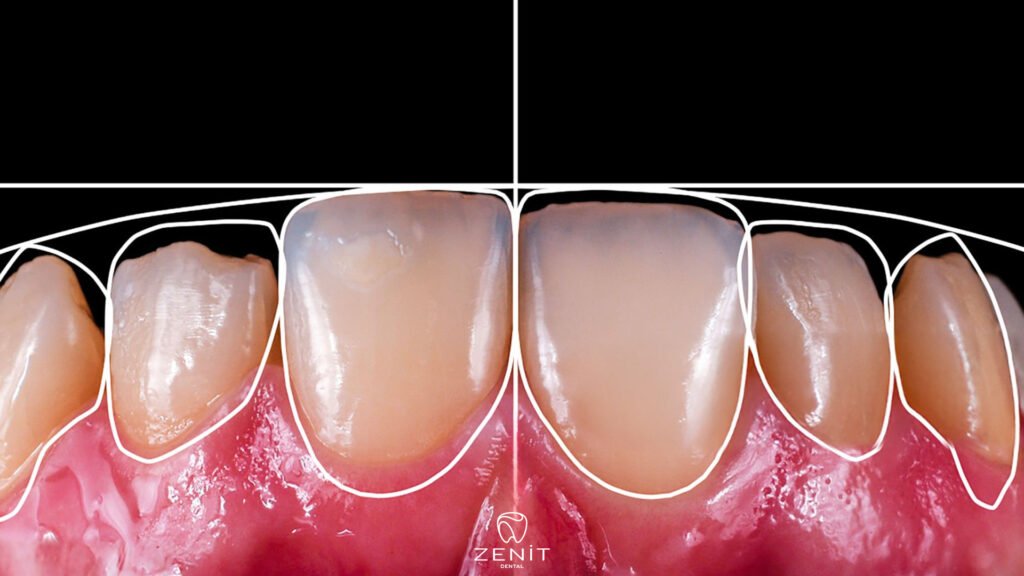 What Is Smile Design