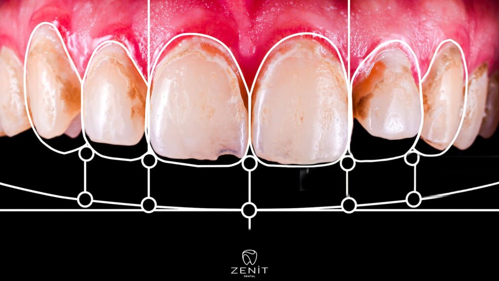 What Is Smile Design