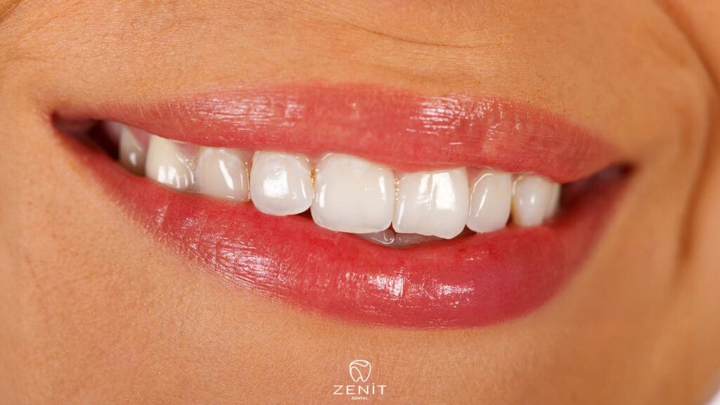 What Is Smile Design