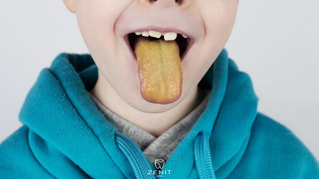 Dil Sararması Nedenleri