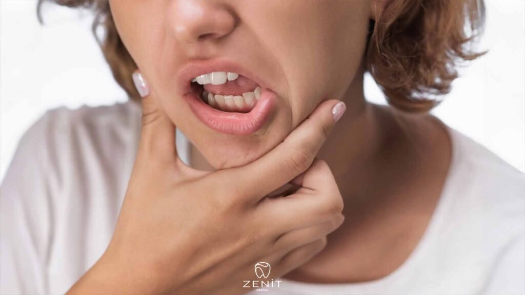 Causes of Tooth Sensitivity
