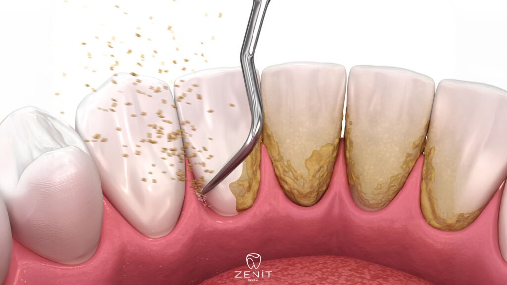 Koruyucu Diş Hekimliği Nedir