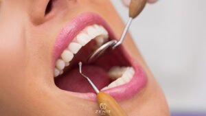 Koruyucu Diş Hekimliği Nedir