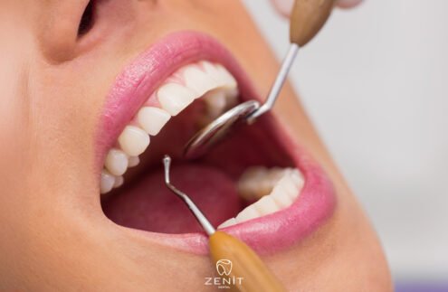 Koruyucu Diş Hekimliği Nedir