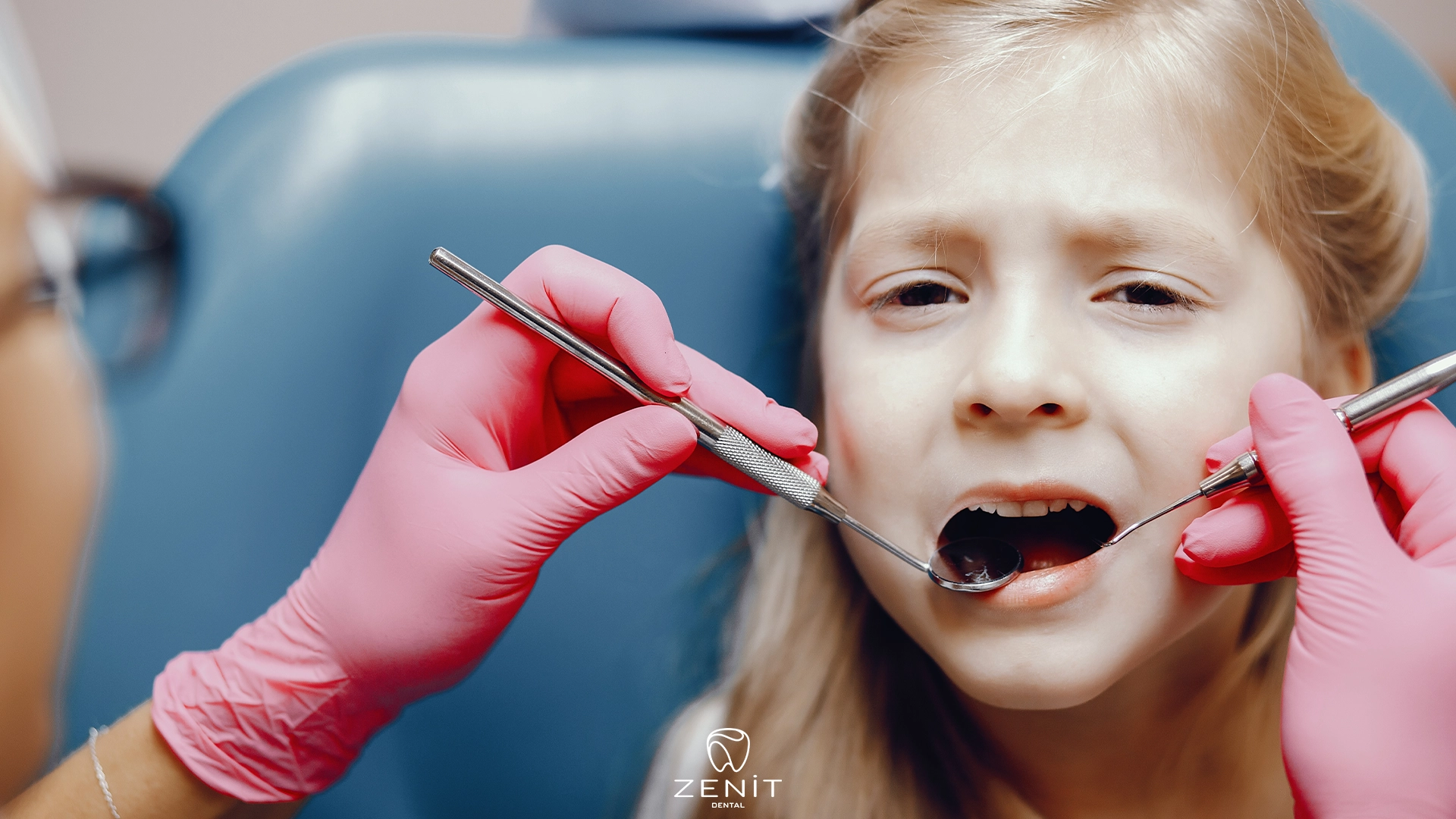 Tooth Decay in Children: 8 Causes and 7 Prevention Tips